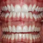 Thumbnail Image1
