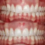 Thumbnail Image2