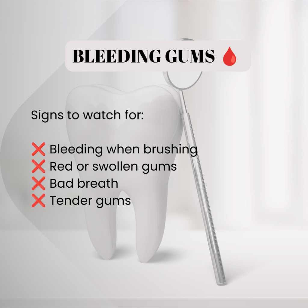 Bleedinggums