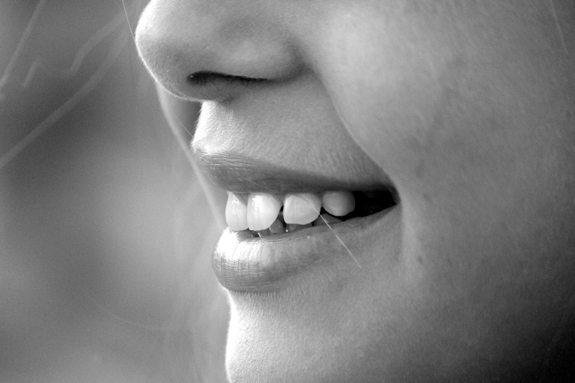 Whiter smiles for Summer! (Teeth Whitening)