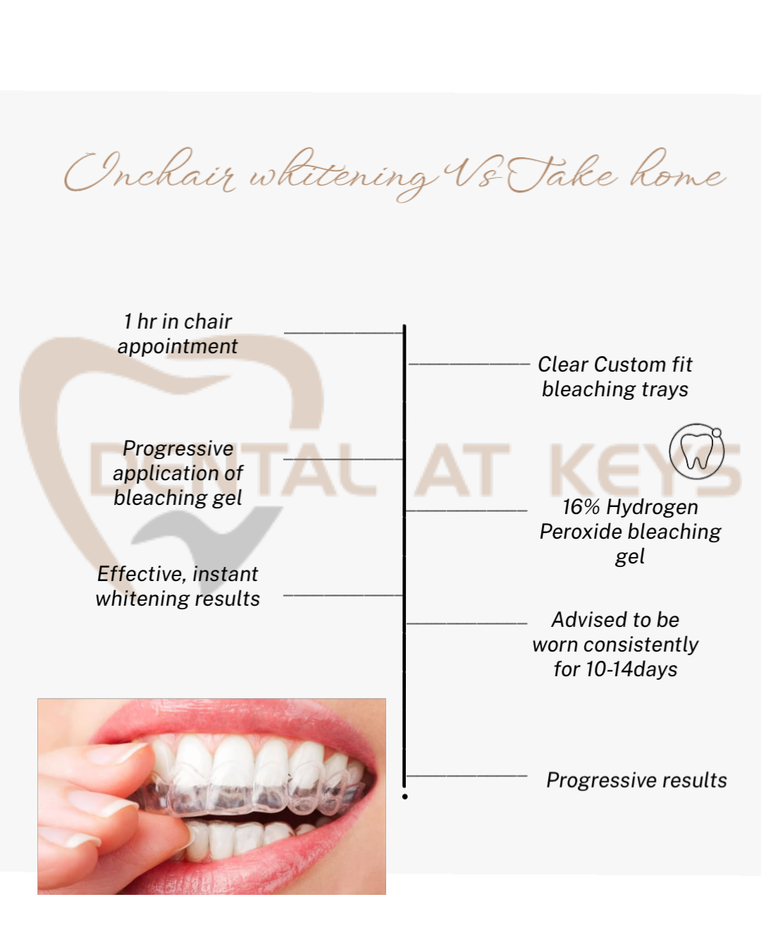 Teeth whitening Options
