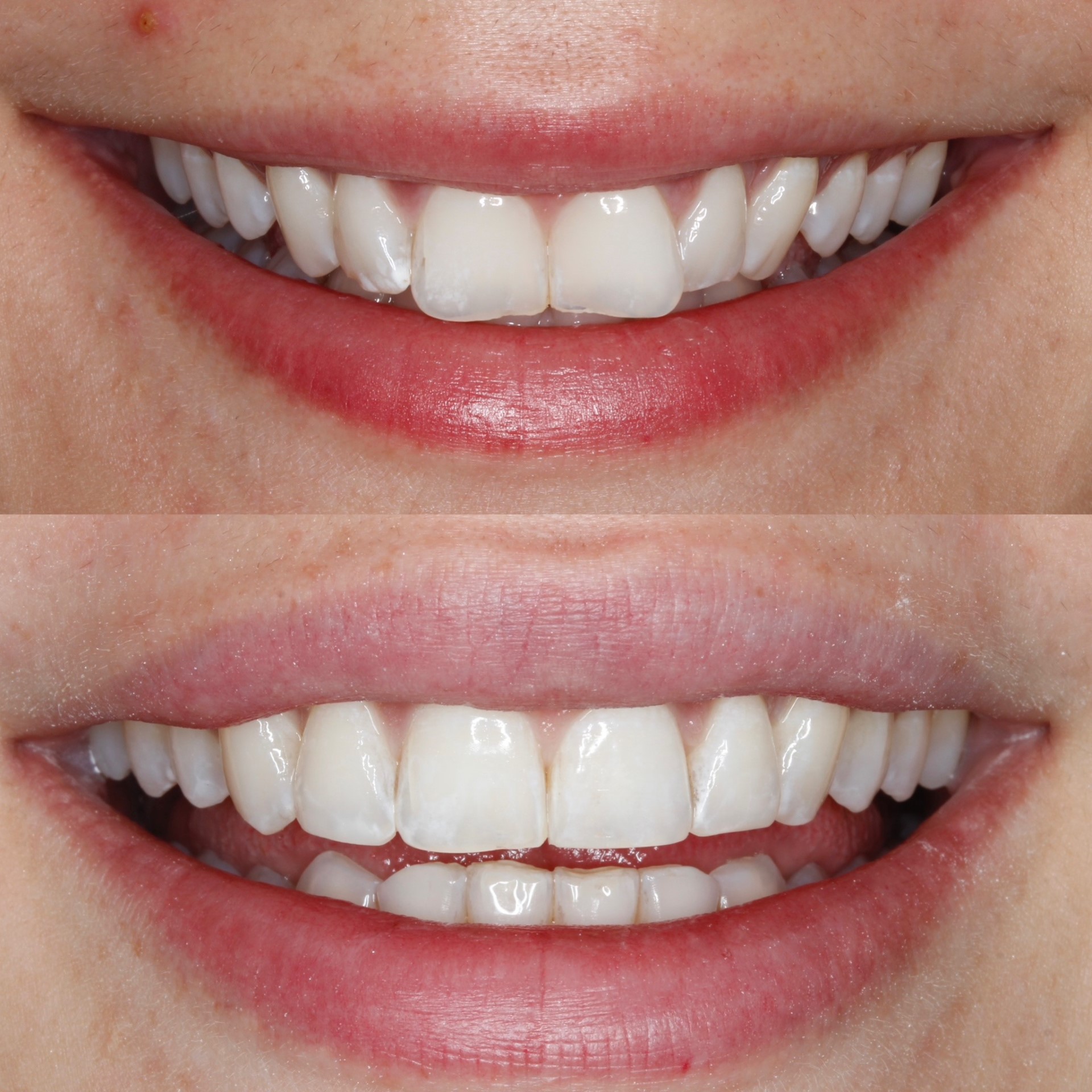 A journey to the perfect Smile! ✨🦷