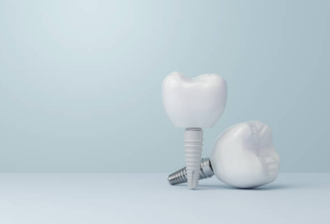 Zirconia Implants