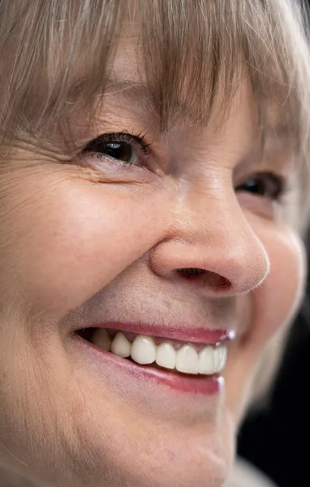 old woman with veneers and crowns