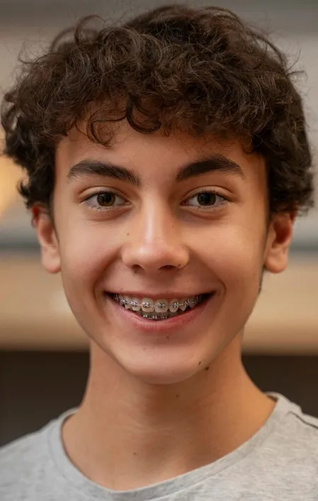 boy had jaw expansion with braces