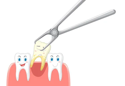 tooth extraction cartoon