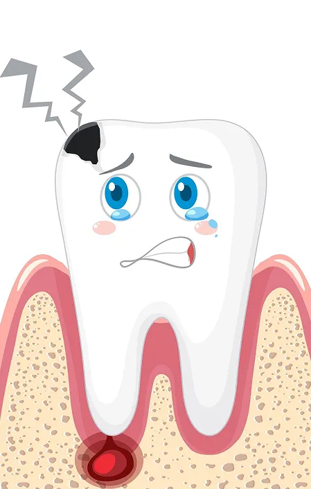tooth infogram with decay and abscess