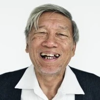 Senior Citizen With Yellow Tooth Decay Smiling Thumbnail