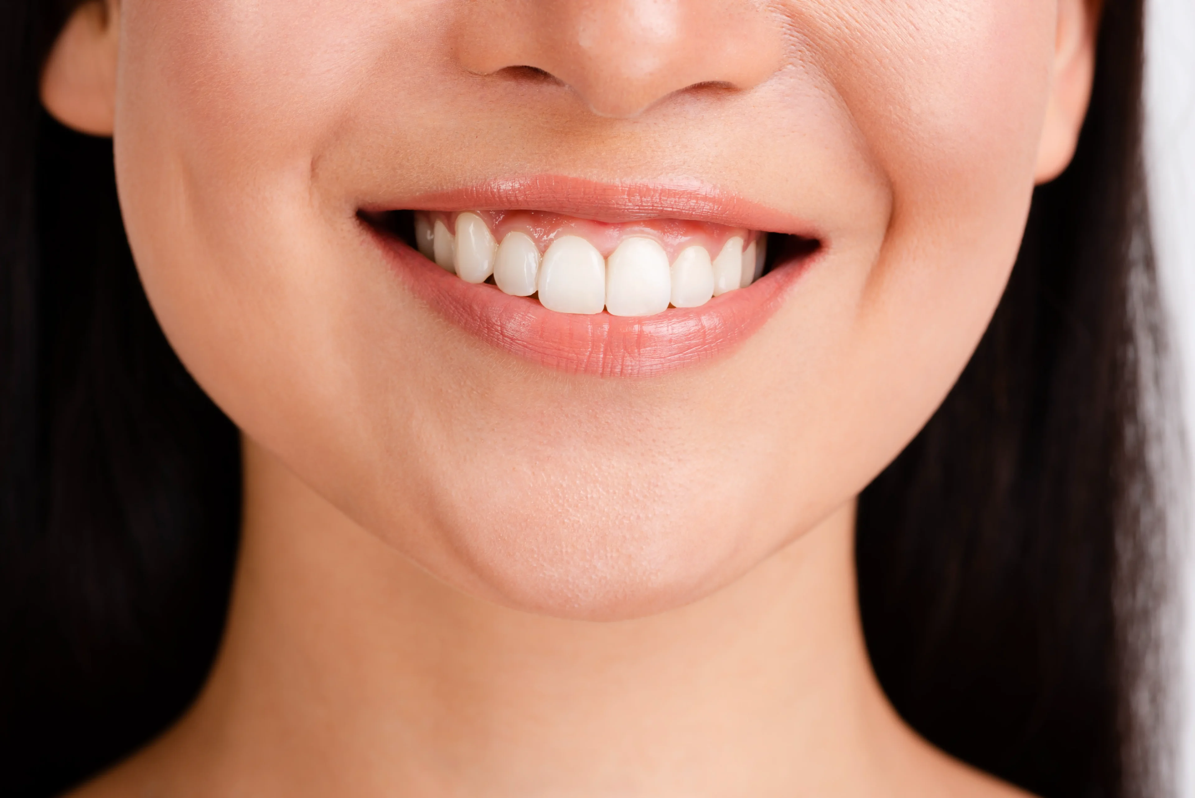 woman smiling with whitened teeth