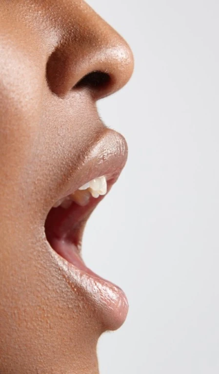 Profile Black Woman With Open Dry Mouth