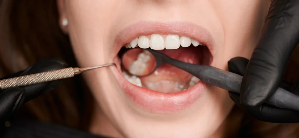 Receding Gums Banner