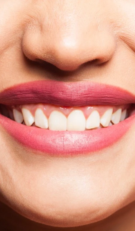 Woman Smiling Showing Gums