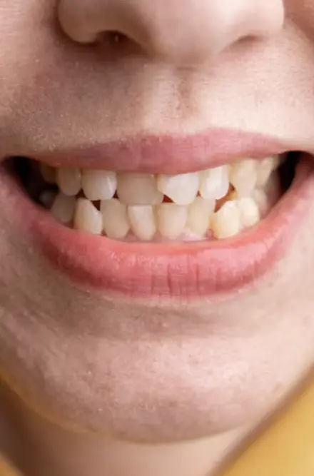 Woman With Crooked Teeth Portrait